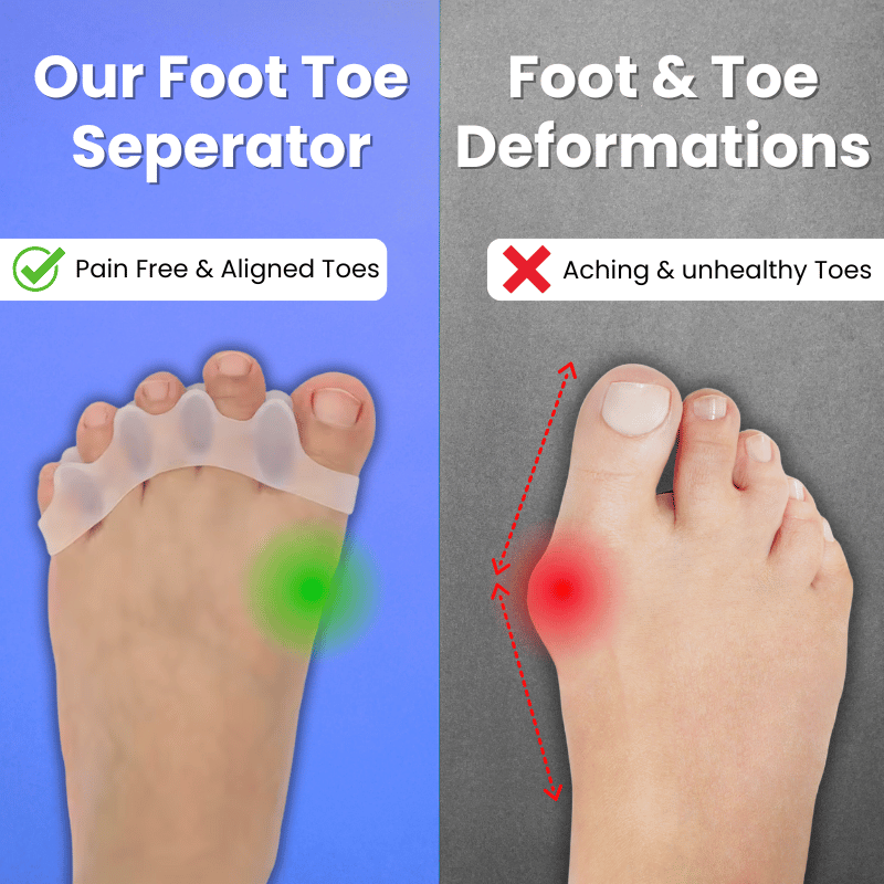 Foot Toe Separator - Correct Bunions & Hammer Toes Naturally – Feel the Relief