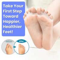 Foot Toe Separator - Correct Bunions & Hammer Toes Naturally – Feel the Relief